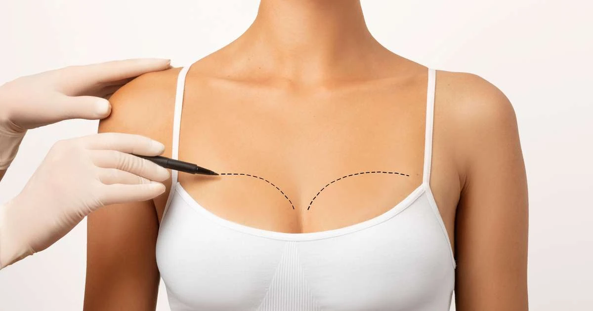 Cirurgia plástica: busca por resultados naturais é tendência