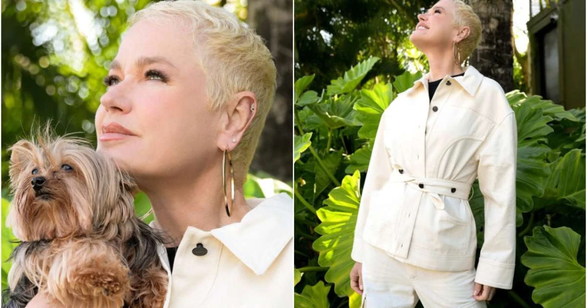 Transplante capilar de Xuxa já tem resultado: saiba quanto custa e quem pode fazer
