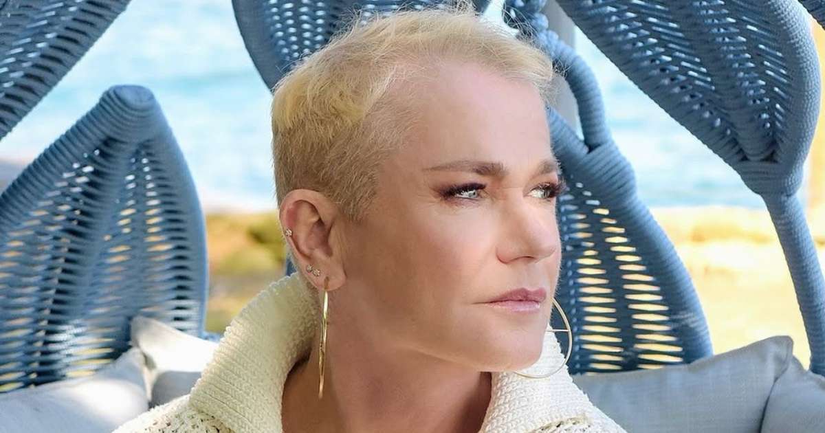 Xuxa faz implante capilar e sonha em usar penteado clássico