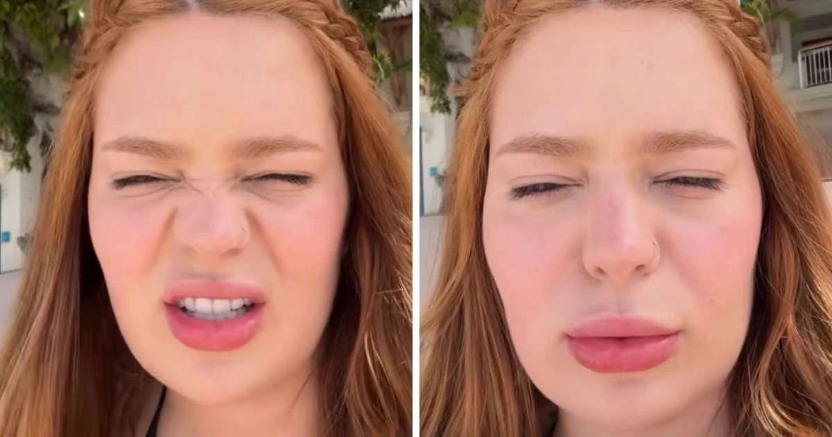 Viih Tube lamenta resultado de botox aos 25 anos: 'Coisa esquisita'