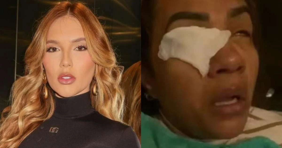 GRAVE! Mulher afirma que ficou cega após usar produto de Virginia Fonseca