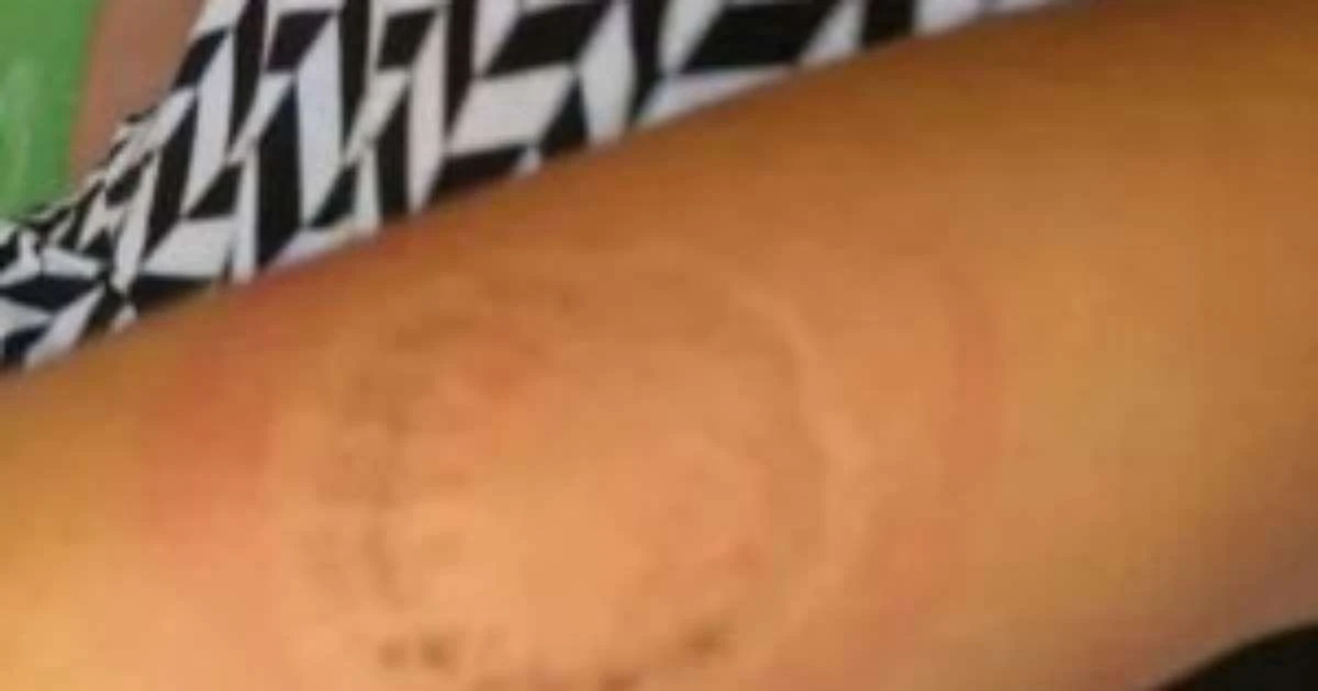 Mulher morde professoras de creche em Camaragibe ao alegar que filho autista foi agredido
