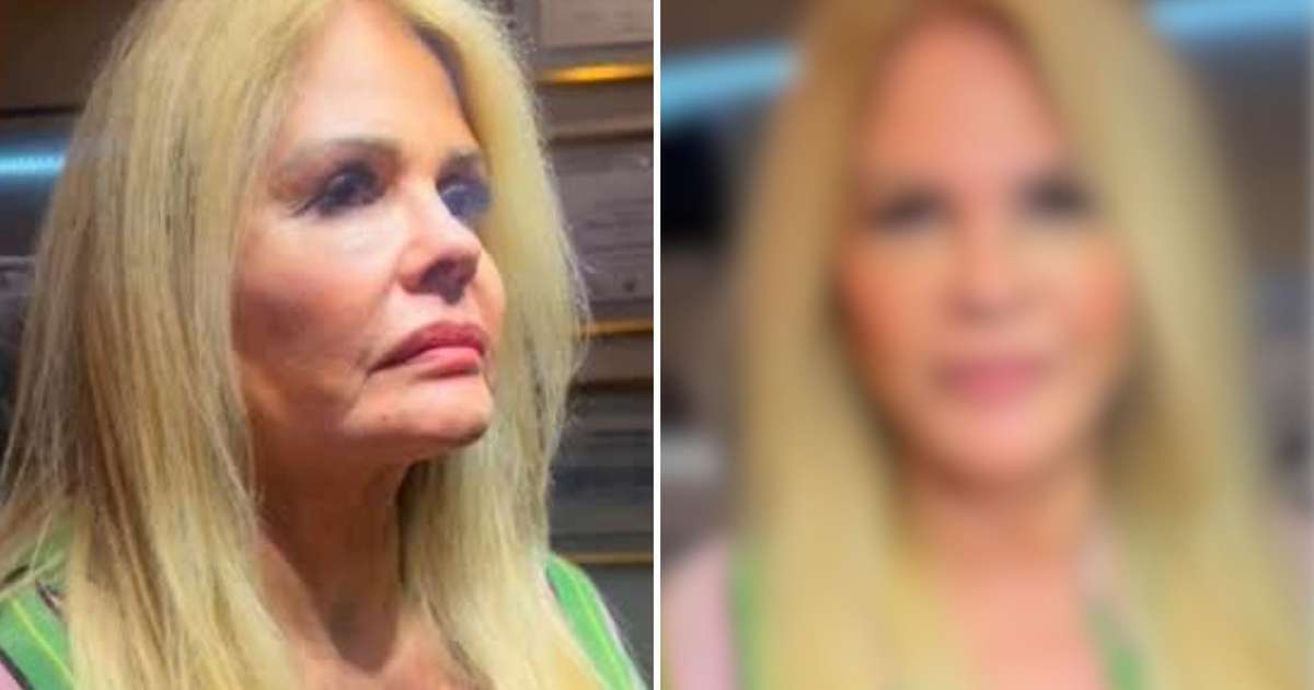 Monique Evans surge com rosto renovado após harmonização: veja antes e depois