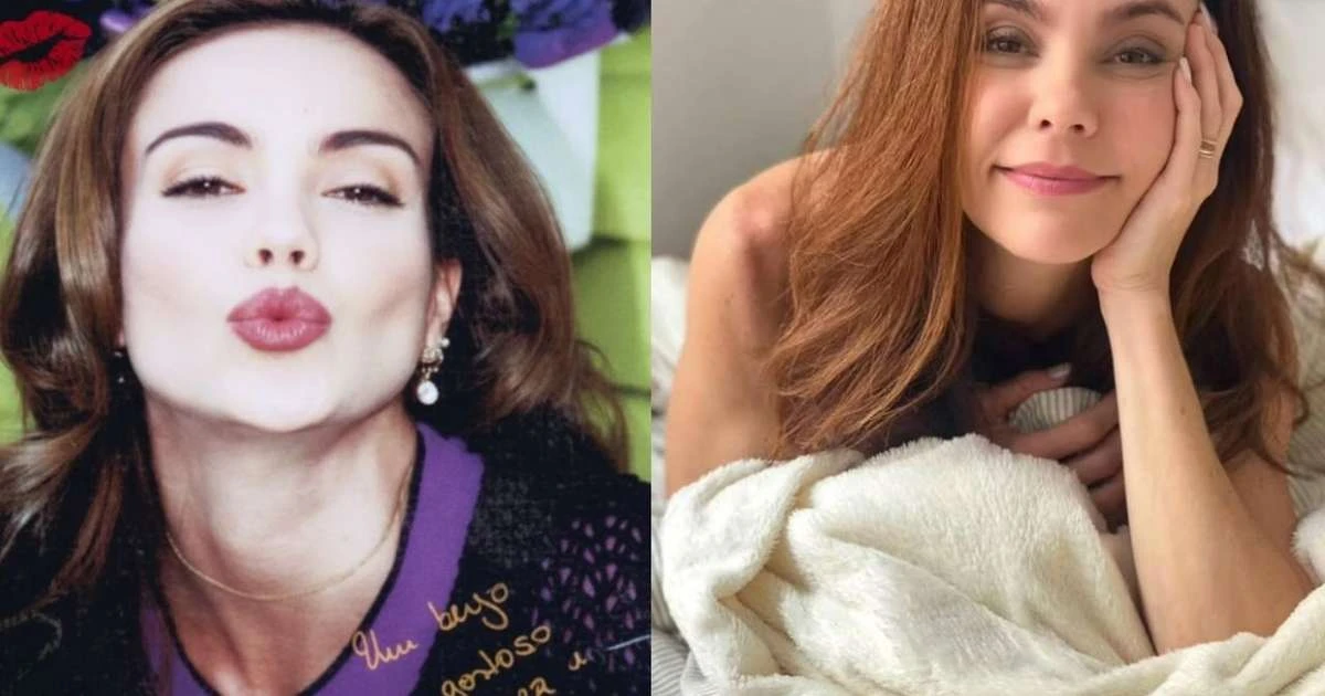 Flávia Monteiro revela cicatriz após cirurgia para retirar tumor na perna