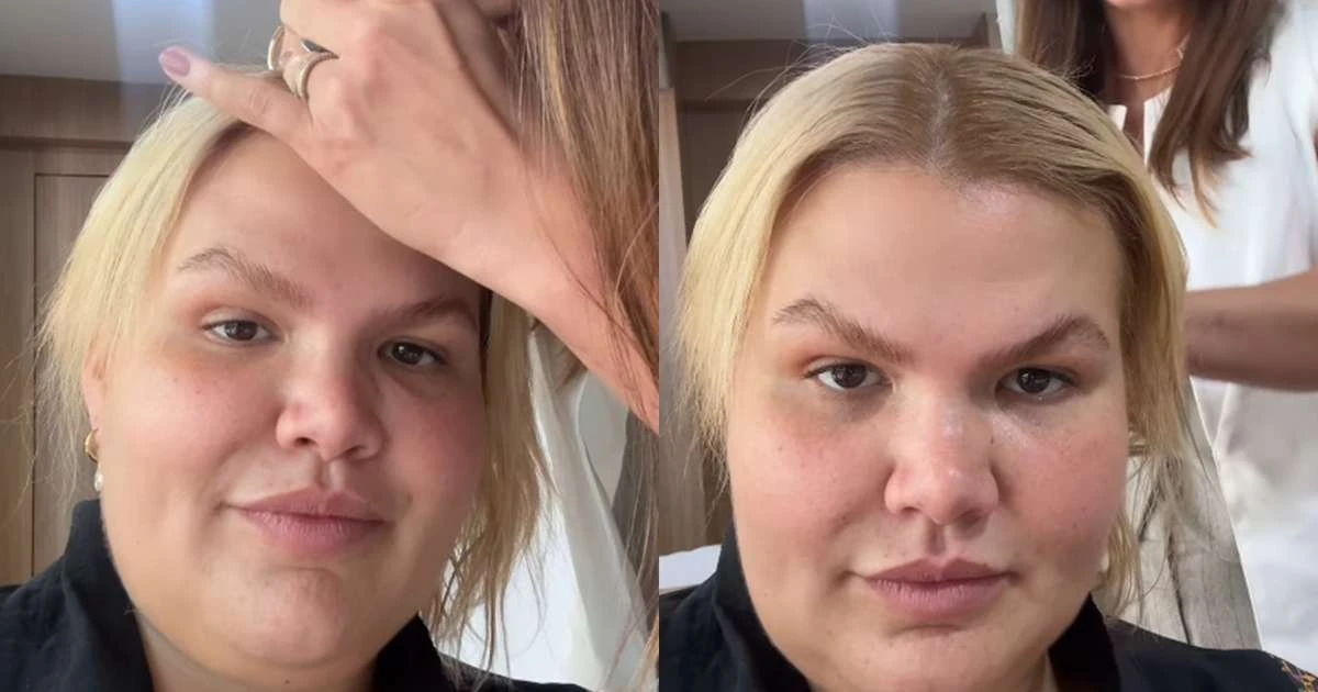 Vai ficar careca? Thais Carla expõe queda de cabelo após bariátrica: 'Isso se agravou'