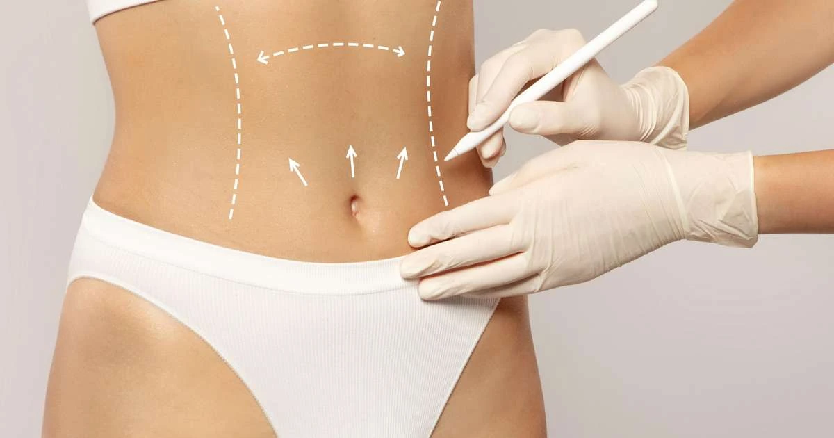 Cirurgia plástica corporal e de rejuvenescimento é tendência