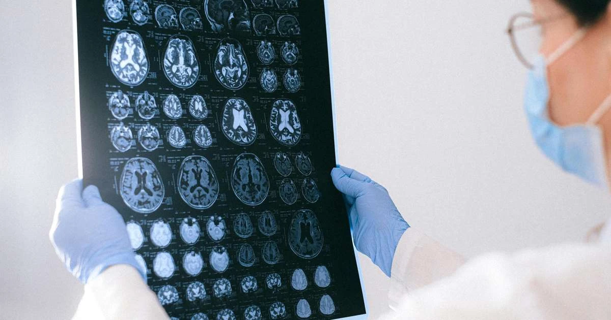 BrainAge: tecnologia indica a idade cerebral