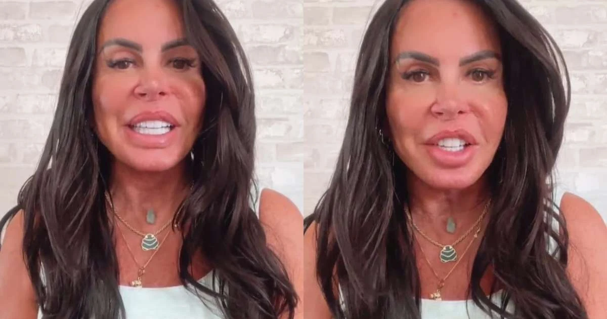 Gretchen recebe diagnóstico delicado após desistir do 'Power Couple': 'Fazendo tratamentos'