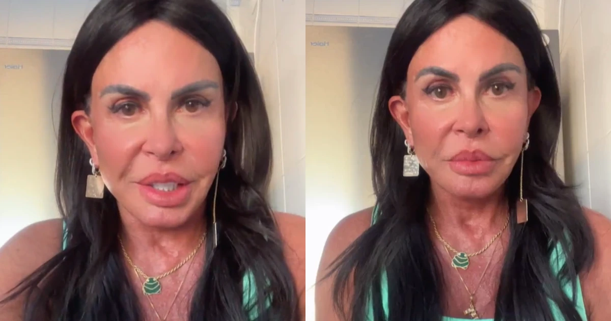 Gretchen passa por mais uma harmonização facial e apresenta novo rosto