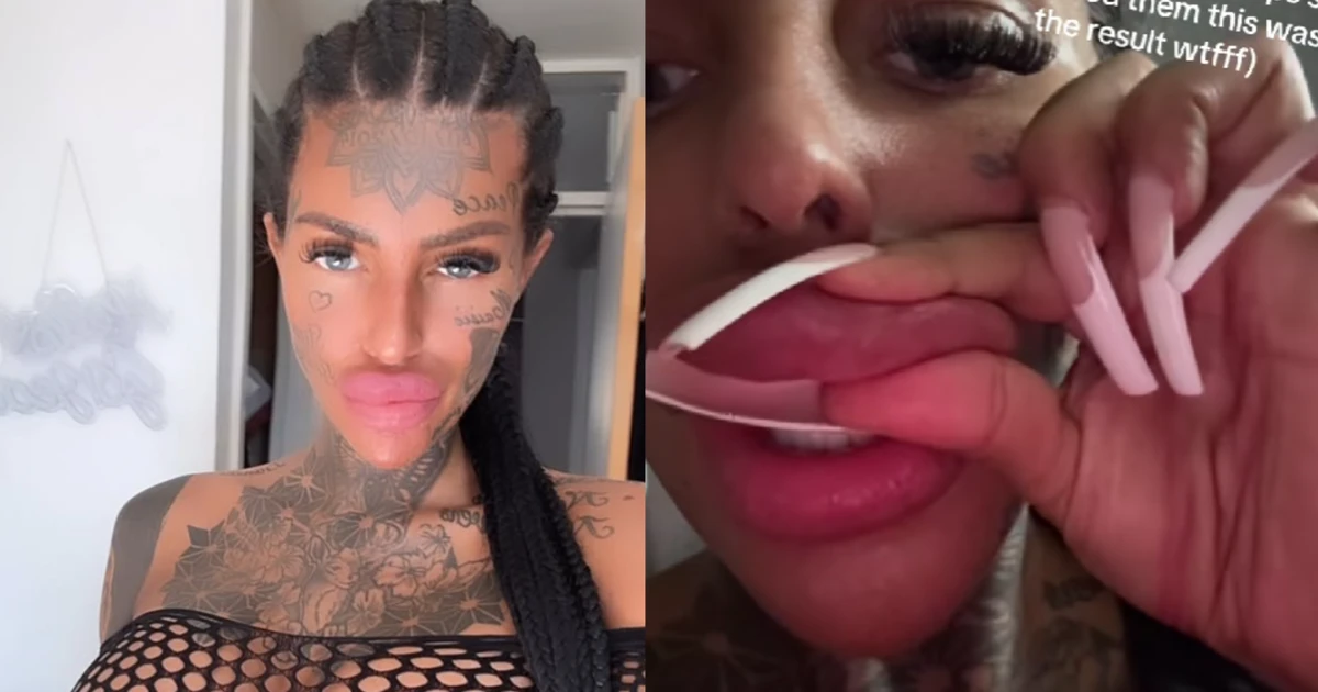 Influenciadora britânica viraliza após exibir lábios 'vazando' preenchimento