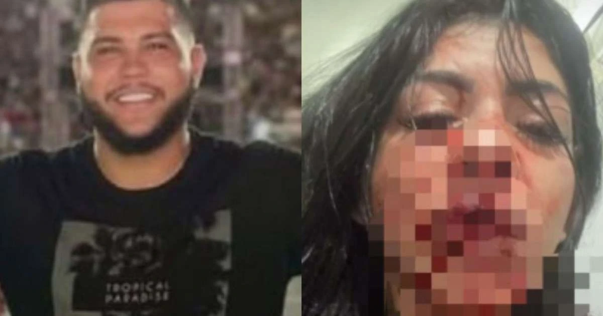 Absurdo! Cantor de forró chora após socar a namorada e deixá-la sem os dentes
