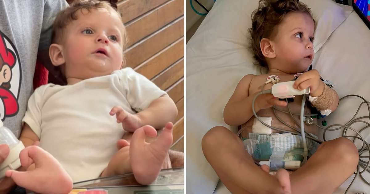 Bebê enfrenta 20 horas de diálise por dia devido a falta de transplante; entenda