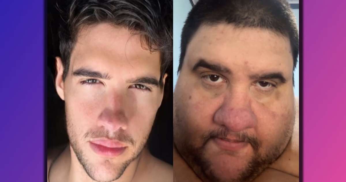 Morre influenciador que chegou a pesar 380 kg e comoveu com luta para emagrecer