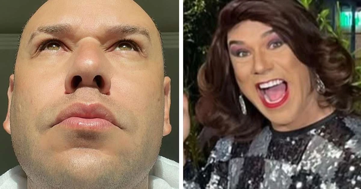 Tiago Barnabé, a Narcisa, revela procedimento estético e declara: 'Muda por completo'