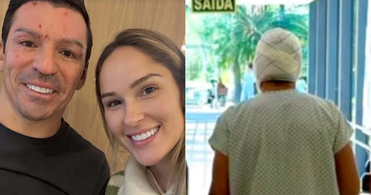 Ex-jogador da seleção mostra o rosto pela primeira vez após sofrer queimaduras em 18% do corpo
