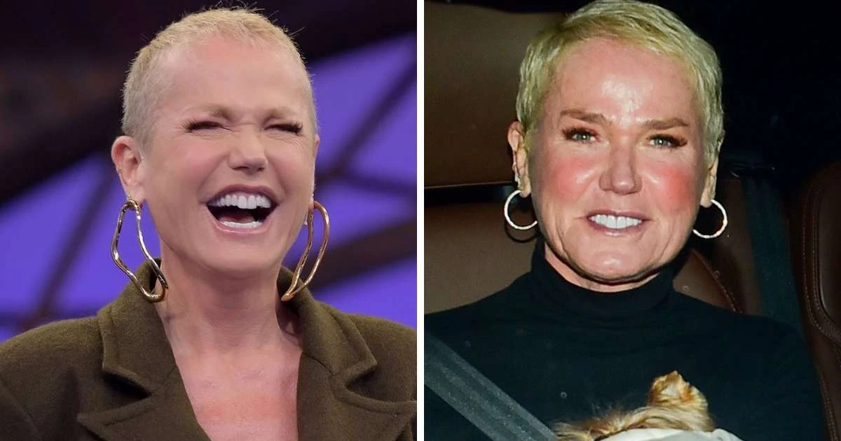 Xuxa surge com cabelos volumosos seis meses após transplante; veja antes e depois