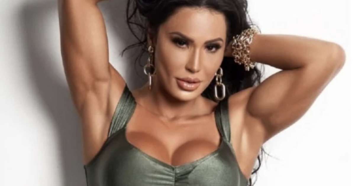 Outra mulher! Gracyanne Barbosa remove preenchimentos no rosto; confira resultado