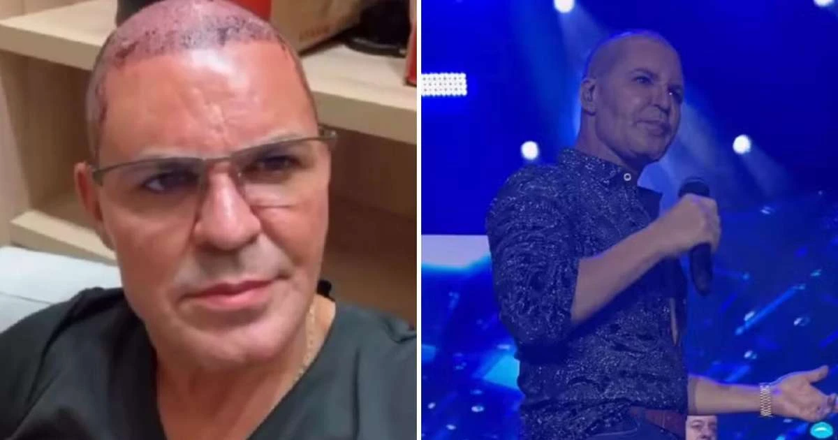 Eduardo Costa faz show careca: 'Não estou preocupado com minha aparência'