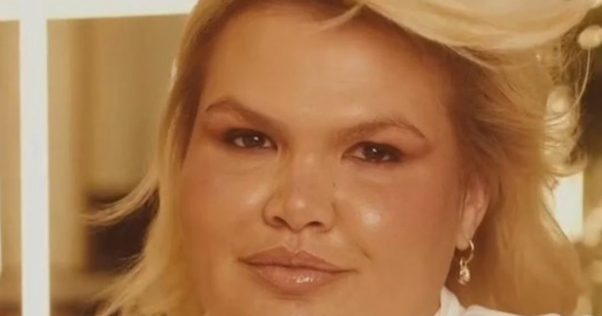 Thais Carla revela problema que está enfrentando após cirurgia bariátrica