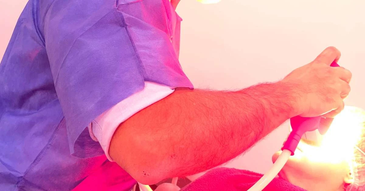 Síndrome do olho seco pode ser tratada com luz pulsada