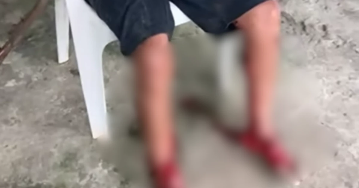 Homem tem múltiplos ferimentos nas pernas após ser atacado por cachorros no litoral de SP