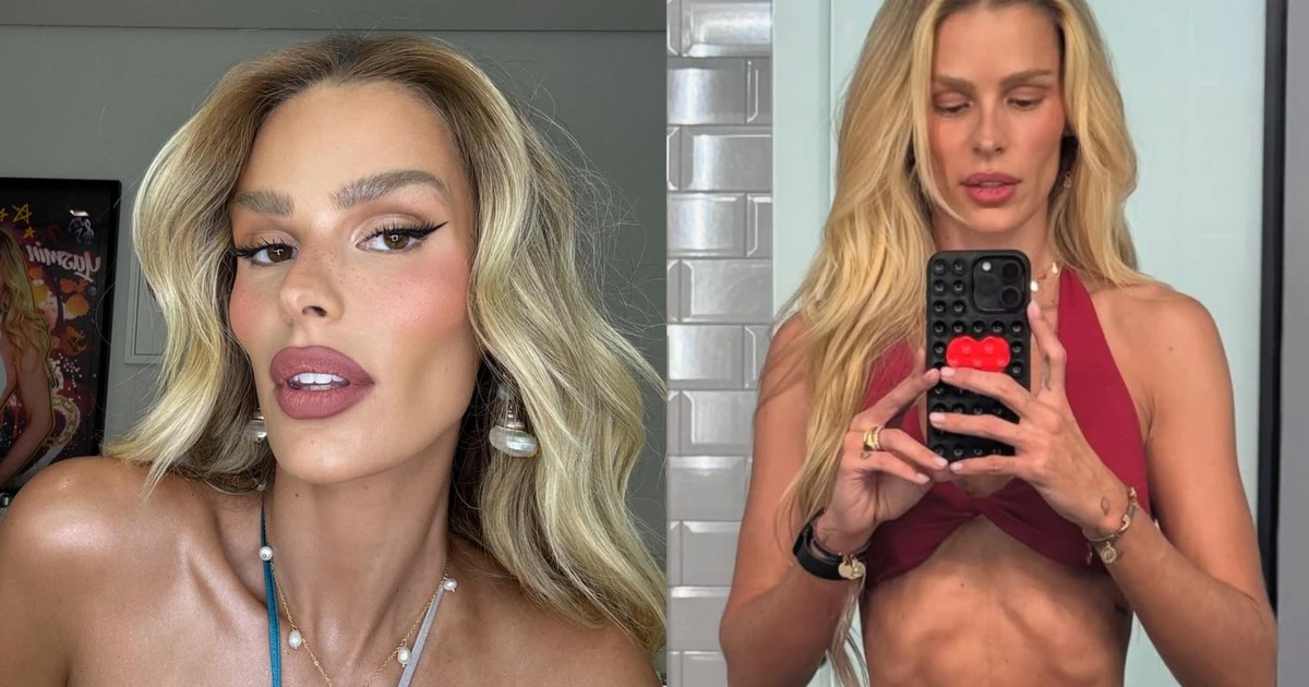 Yasmin Brunet abre o coração e desabafa após perder 20kg: 'Doença crônica'