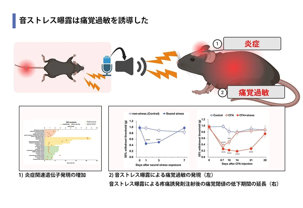 “痛み”は音で伝搬する──東京理科大　「ストレス音のない医療環境が重要」